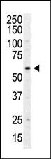 Anti-PI4K2A Rabbit Polyclonal Antibody