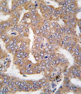 Anti-PAK4 Rabbit Polyclonal Antibody (Biotin)