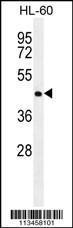 Anti-NR6A1 Rabbit Polyclonal Antibody (AP (Alkaline Phosphatase))