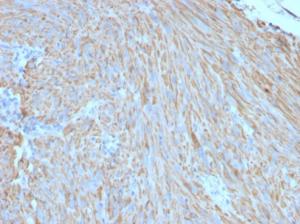 Anti-c-Kit Mouse Monoclonal Antibody [clone: C117/370]