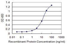 Anti-TSHZ1 Mouse Monoclonal Antibody [clone: 2F1]