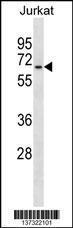 Anti-GALNT14 Rabbit Polyclonal Antibody (AP (Alkaline Phosphatase))