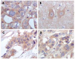 Anti-STYK1 Mouse Monoclonal Antibody [clone: 2H2F10]