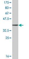 Anti-TNNT3 Mouse Monoclonal Antibody [clone: 1H4]