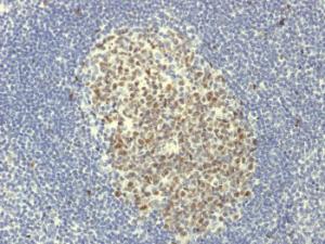 Immunohistochemical analysis of formalin-fixed, paraffin-embedded human tonsil using Anti-Bcl-6 Antibody [BCL6/1951R]