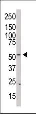 Anti-PI 4 Kinase type 2 beta Rabbit Polyclonal Antibody