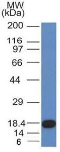 Western blot analysis of recombinant fragment of CD117 using Anti-c-Kit Antibody [KIT/982]