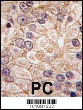 Anti-PI 4 Kinase type 2 beta Rabbit Polyclonal Antibody