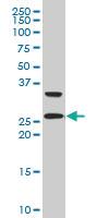 Anti-ARHGDIG Mouse Polyclonal Antibody