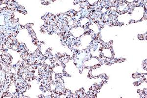 Immunohistochemistry analysis of paraffin-embedded rat lung using Anti-PDCD4 Antibody [ARC1398] (A307976) at a dilution of 1:100 (40X lens). Perform microwave antigen retrieval with 10 mM Tris/EDTA buffer pH 9.0 before commencing with IHC staining protocol