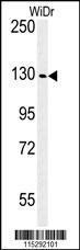 Anti-IGF1R Rabbit Polyclonal Antibody