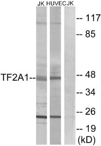 Western blot analysis of lysates from Jurkat and HUVEC cells using Anti-TF2A1 Antibody. The right hand lane represents a negative control, where the antibody is blocked by the immunising peptide.