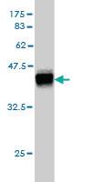 Anti-DSC3 Mouse Monoclonal Antibody [clone: 4D2]