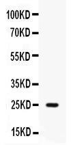 Anti-Elafin/Skalp Antibody