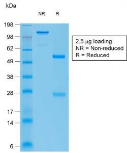 SDS-PAGE analysis of Anti-Bcl-6 Antibody [BCL6/1951R] under non-reduced and reduced conditions; showing intact IgG and intact heavy and light chains, respectively SDS-PAGE analysis confirms the integrity and purity of the antibody