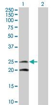 Anti-IL6 Mouse Monoclonal Antibody [clone: 2C5]