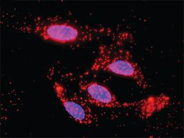 Anti-CDKN1B Antibody Pair