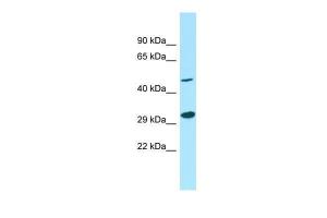 Anti-GNA13 Rabbit Polyclonal Antibody