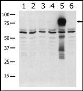 Anti-PAK6 Rabbit Polyclonal Antibody (Biotin)