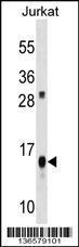 Anti-ATP5D Rabbit Polyclonal Antibody (Biotin)