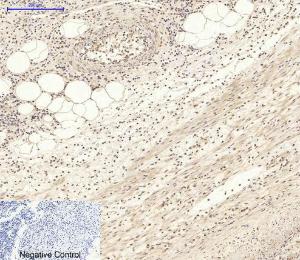 Immunohistochemical analysis of paraffin-embedded human Appendix tissue using Anti-AKT1 + AKT2 + AKT3 Antibody at 1:200 (4°C overnight) Negative control was secondary antibody only