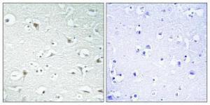 Immunohistochemical analysis of paraffin-embedded human brain using Anti-TF2A1 Antibody 1:100 (4°C overnight). The right hand panel represents a negative control, where the antibody was pre-incubated with the immunising peptide.