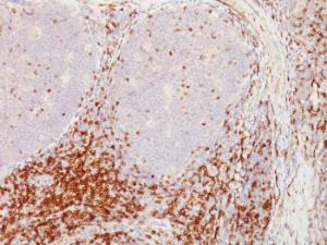 Immunohistochemical analysis of formalin-fixed, paraffin-embedded human tonsil using Anti-CD5 Antibody [CD5/54/F6]