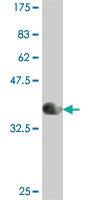 Anti-TACC3 Mouse Polyclonal Antibody