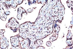 Immunohistochemistry analysis of paraffin-embedded human placenta using Anti-PDCD4 Antibody [ARC1398] (A307976) at a dilution of 1:100 (40X lens). Perform microwave antigen retrieval with 10 mM Tris/EDTA buffer pH 9.0 before commencing with IHC staining protocol