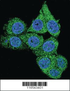 Anti-CCL15 Rabbit Polyclonal Antibody