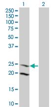 Anti-IL6 Mouse Monoclonal Antibody [clone: 3F12]