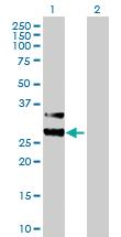 Anti-MTIF3 Mouse Polyclonal Antibody