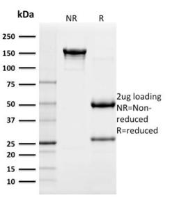 SDS-PAGE analysis of Anti-c-Kit Antibody [KIT/982] under non-reduced and reduced conditions; showing intact IgG and intact heavy and light chains, respectively SDS-PAGE analysis confirms the integrity and purity of the antibody