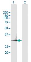 Anti-PSME3 Mouse Polyclonal Antibody