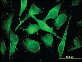 Anti-COMMD3 Mouse Monoclonal Antibody [clone: 2E2]