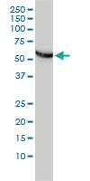 Anti-CCT5 Mouse Monoclonal Antibody [clone: 4E5-4B1]