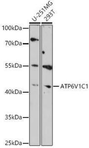 Anti-ATP6V1C1 Rabbit Polyclonal Antibody