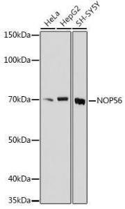 Western blot analysis of extracts of various cell lines, using Anti-NOL5A Antibody (A307977) at 1:1,000 dilution The secondary antibody was Goat Anti-Rabbit IgG H&L Antibody (HRP) at 1:10,000 dilution Lysates/proteins were present at 25 µg per lane