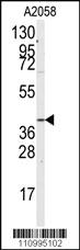 Anti-GNA12 Rabbit Polyclonal Antibody