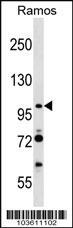 Anti-MAP3K9 Rabbit Polyclonal Antibody