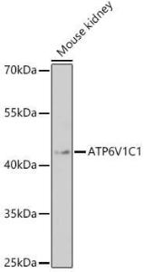 Anti-ATP6V1C1 antibody