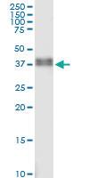 Anti-PHOX2A Rabbit Polyclonal Antibody