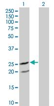 Anti-IL6 Mouse Monoclonal Antibody [clone: 4B12]