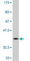 Anti-HSFY1 Mouse Monoclonal Antibody [clone: 1D2]