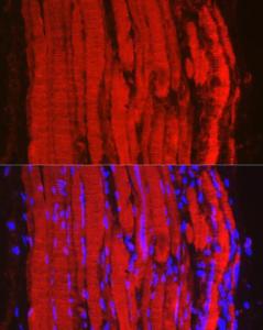 Immunofluorescence analysis of mouse skeletal muscle using Anti-Fbx32 Antibody (A12024) at a dilution of 1:100 (40x lens). DAPI was used to stain the cell nuclei (blue)