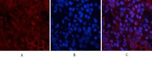 Immunofluorescence analysis of human stomach tissue using Anti-AKT1 + AKT2 + AKT3 Antibody (red) at 1:200 (4°C overnight) Cy3 labelled secondary antibody was used at 1:300 (RT 50min) Panel A: Target Panel B: DAPI Panel C: Merge