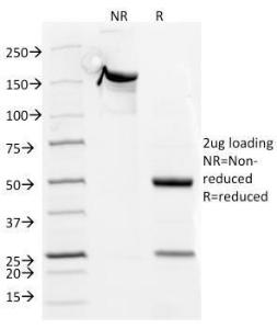 SDS-PAGE analysis of Anti-CD5 Antibody [CD5/54/F6] under non-reduced and reduced conditions; showing intact IgG and intact heavy and light chains, respectively. SDS-PAGE analysis confirms the integrity and purity of the antibody