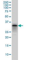 Anti-PHOX2A Mouse Monoclonal Antibody [clone: 4F6]