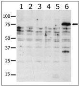 Anti-PAK6 Rabbit Polyclonal Antibody (APC (Allophycocyanin))