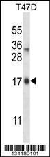 Anti-IGF2AS Rabbit Polyclonal Antibody (AP (Alkaline Phosphatase))